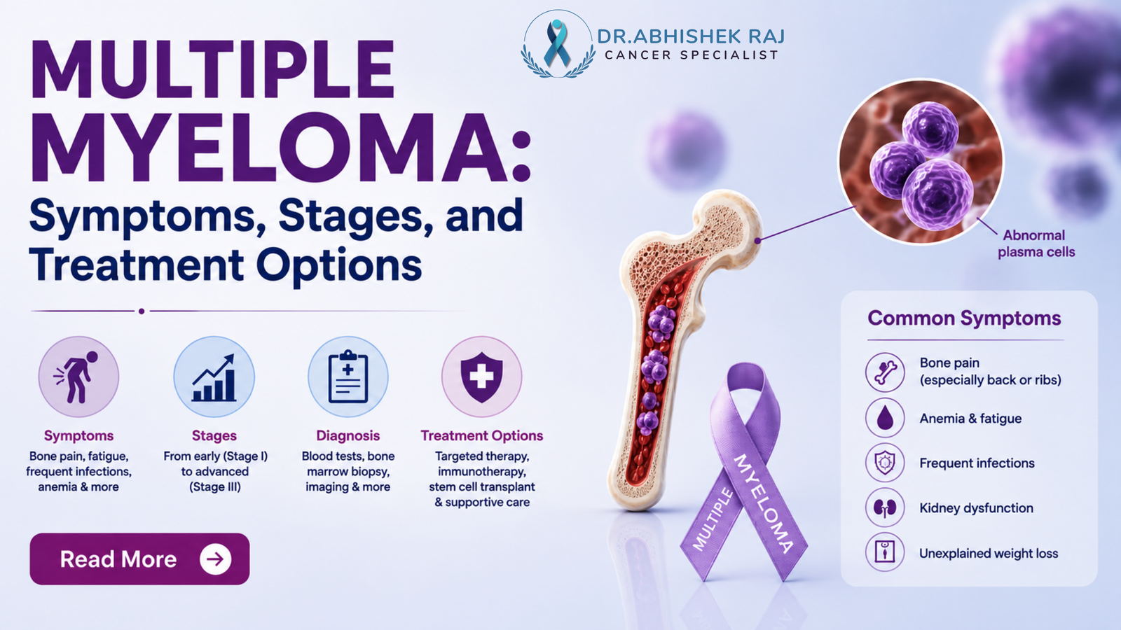 Multiple Myeloma: Symptoms, Stages, and Treatment Options